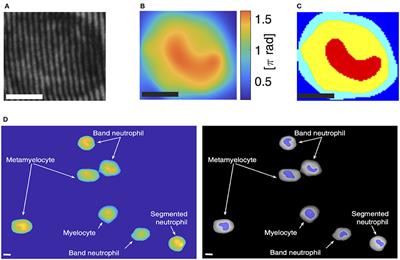 Monitoring Human Neutrophil Differentiation by Digital Holographic Microscopy